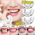 3Pcs Set Teeth Brace Corrector Bend Aligner