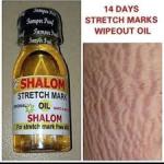 Shalom Stretch Marks Removal Oil