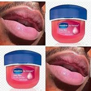 Vaseline Pink Lip Balm Therapy For Pink Lips